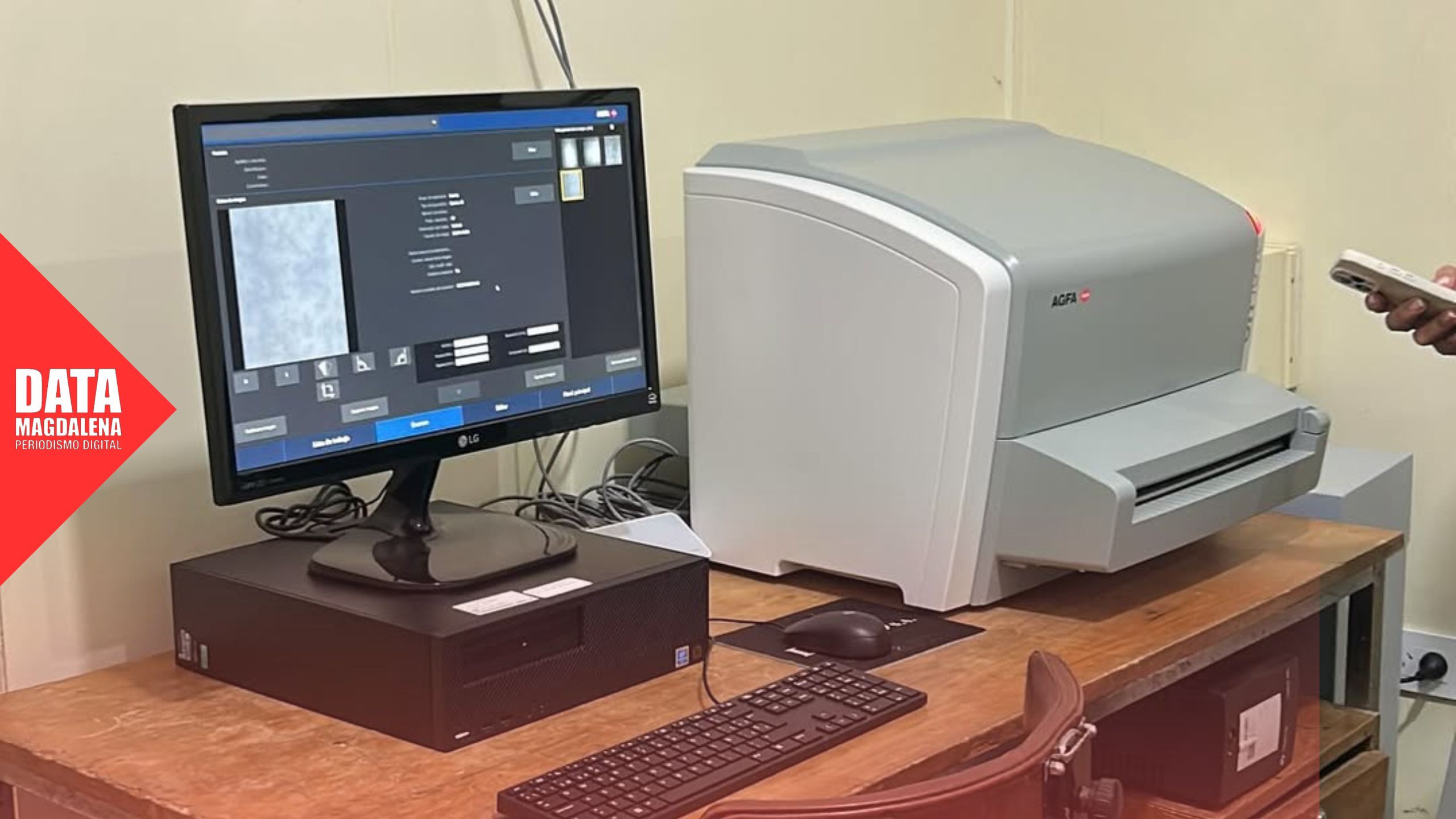 🩻 Bavio incorpora un moderno sistema digital de rayos X para su Unidad Sanitaria
